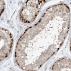 Immunohistochemical staining of human testis shows high expression.