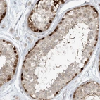 Immunohistochemical staining of human testis shows high expression.