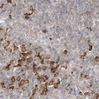 Immunohistochemical staining of human lymph node using Anti-RNF219 antibody HPA034786.