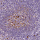 Immunohistochemical staining of human tonsil shows moderate membranous positivity in germinal center cells.