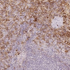 Immunohistochemical staining of human spleen shows strong membranous positivity in cells in red pulp.