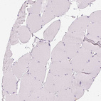 Immunohistochemical staining of human skeletal muscle shows no positivity in myocytes.