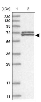 Lane 1: Marker [kDa] 230, 130, 95, 72, 56, 36, 28, 17, 11_br/_Lane 2: Human cell line RT-4