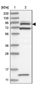 Lane 1: Marker [kDa] 230, 130, 95, 72, 56, 36, 28, 17, 11_br/_Lane 2: Human cell line RT-4