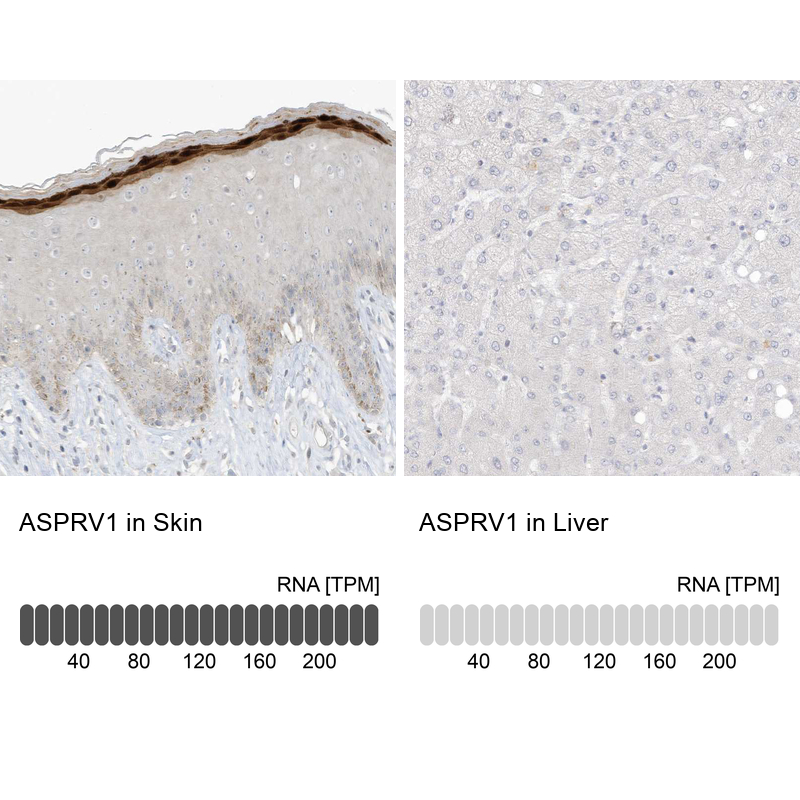 Anti-ASPRV1 Antibody