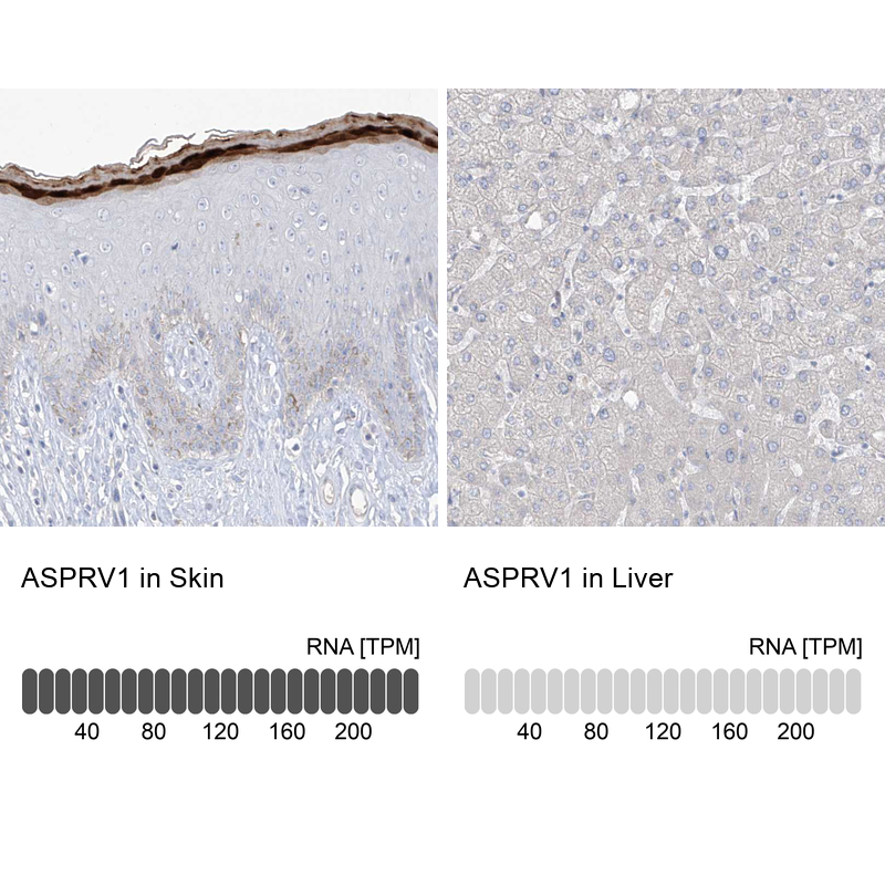 Anti-ASPRV1 Antibody