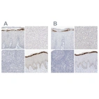 Immunohistochemical staining of human cervix, uterine, liver, lymphoid tissues and skin using Anti-ASPRV1 antibody HPA034809 (A) shows similar protein distribution across tissues to independent antibody HPA034810 (B).