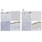 Immunohistochemical staining of human cervix, uterine, liver, lymphoid tissues and skin using Anti-ASPRV1 antibody HPA034810 (A) shows similar protein distribution across tissues to independent antibody HPA034809 (B).