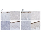 Immunohistochemical staining of human cervix, uterine, liver, lymphoid tissues and skin using Anti-ASPRV1 antibody HPA034810 (A) shows similar protein distribution across tissues to independent antibody HPA034809 (B).