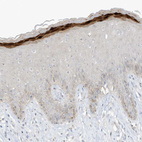 Immunohistochemical staining of human skin shows strong cytoplasmic positivity in keratinocytes.