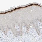 Immunohistochemical staining of human skin shows strong cytoplasmic positivity in keratinocytes.