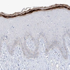 Immunohistochemical staining of human skin shows strong cytoplasmic positivity in keratinocytes.
