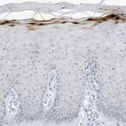 Immunohistochemical staining of human uterine cervix shows moderate to strong cytoplasmic positivity in keratinocytes.