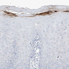 Immunohistochemical staining of human uterine cervix shows moderate to strong cytoplasmic positivity in keratinocytes.