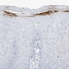 Immunohistochemical staining of human uterine cervix shows moderate to strong cytoplasmic positivity in keratinocytes.