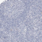 Immunohistochemical staining of human tonsil shows no positivity in non-germinal center cells as expected.