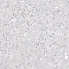 Immunohistochemical staining of human liver shows no positivity in hepatocytes as expected.