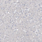 Immunohistochemical staining of human liver shows no positivity in hepatocytes as expected.