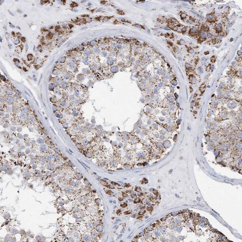 Anti-GTPBP8 Antibody