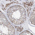 Anti-GTPBP8 Antibody