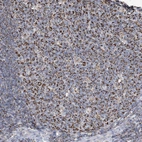 Immunohistochemical staining of human tonsil shows strong granular cytoplasmic positivity in germinal center cells.