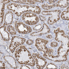 Immunohistochemical staining of human kidney shows strong granular cytoplasmic positivity in cells in tubules.