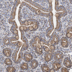 Immunohistochemical staining of human duodenum shows strong granular cytoplasmic positivity in glandular cells.