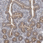 Immunohistochemical staining of human duodenum shows strong granular cytoplasmic positivity in glandular cells.