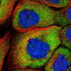 Immunofluorescent staining of human cell line A-431 shows localization to cytosol.