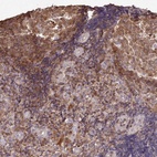 Immunohistochemical staining of human tonsil shows high expression.