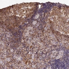 Immunohistochemical staining of human tonsil shows high expression.