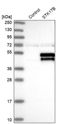 Western blot analysis in control (vector only transfected HEK293T lysate) and STK17B over-expression lysate (Co-expressed with a C-terminal myc-DDK tag (~3.1 kDa) in mammalian HEK293T cells, LY401355).