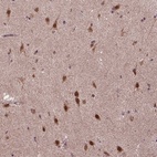 Anti-UBA3 Antibody