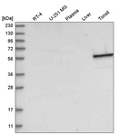 Western blot analysis in human cell line RT-4, human cell line U-251 MG, human plasma, human liver tissue and human tonsil tissue.