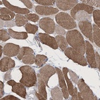 Anti-RTN2 Antibody