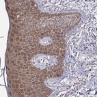 Immunohistochemical staining of human skin shows strong cytoplasmic positivity in squamous epithelial cells.
