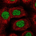 Immunofluorescent staining of human cell line A-431 shows localization to nucleoplasm.