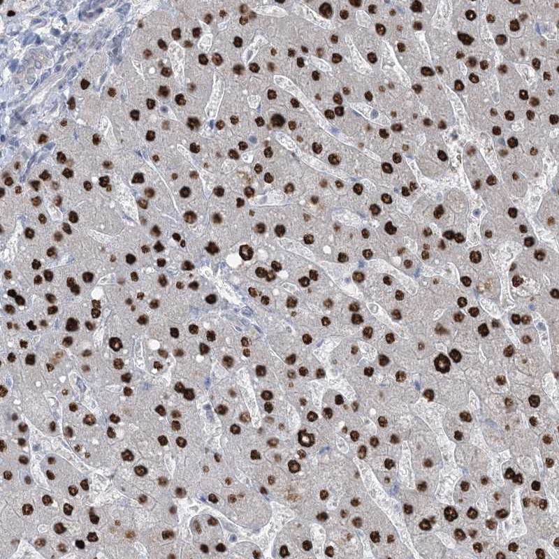 Anti-TFPT Antibody