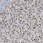 Anti-TFPT Antibody