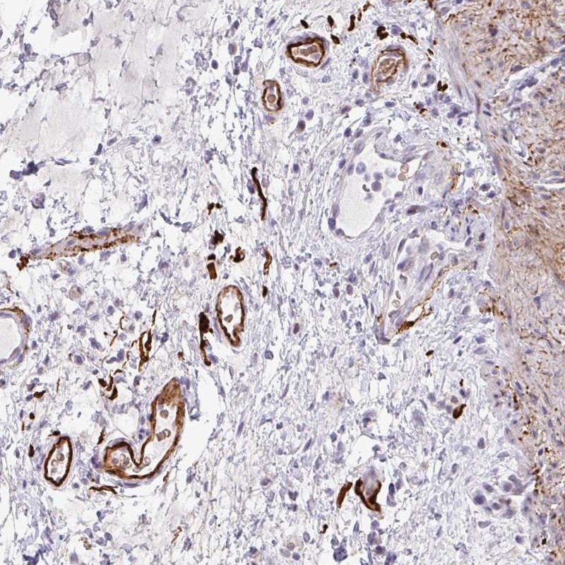 Anti-TNMD Antibody
