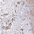 Anti-TNMD Antibody