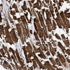 Anti-FAM26E Antibody