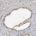 Immunohistochemical staining of human prostate shows moderate to strong nuclear positivity.