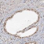 Immunohistochemical staining of human prostate shows moderate to strong nuclear positivity.