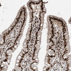 Anti-RBM10 Antibody