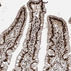 Immunohistochemical staining of human small intestine shows strong nuclear positivity in glandular cells.