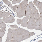 Immunohistochemical staining of human skeletal muscle shows moderate nuclear positivity in myocytes.