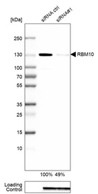 Western blot analysis in A-549 cells transfected with control siRNA, target specific siRNA probe #1, using Anti-RBM10 antibody. Remaining relative intensity is presented. Loading control: Anti-GAPDH.