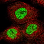 Immunofluorescent staining of human cell line A-431 shows localization to nuclear speckles.