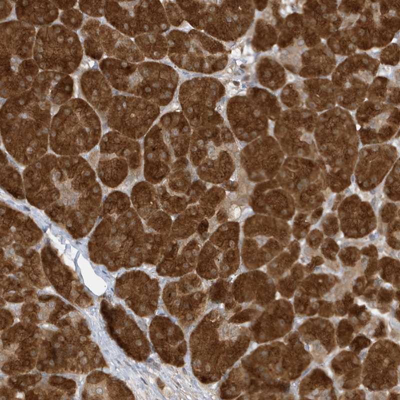 Anti-TAB3 Antibody